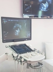 Buy Ultrasound Machine Sales in UK