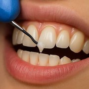 Gum Care in West Hampstead